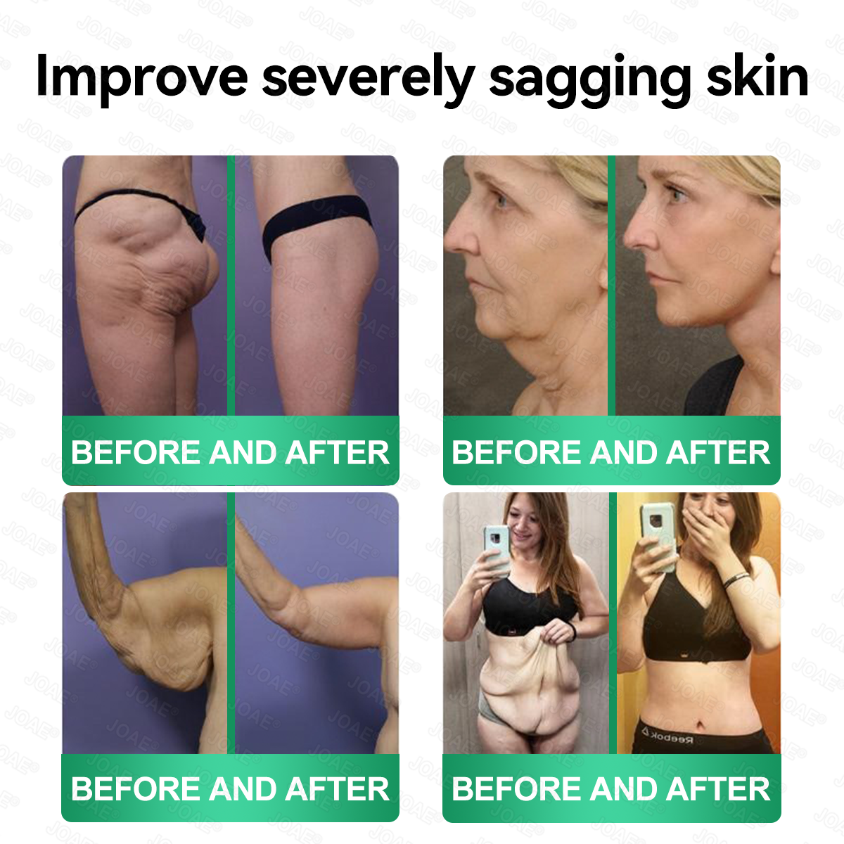 ๐บ๐ธ๐๐๐๐๐๐๐๐ ๐๐ก๐๐๐ |๐ฟ๐๐๐จ๐ฌยฎ ๐๐ผ๐น๐น๐ฎ๐ด๐ฒ๐ป ๐ฃ๐ฒ๐ฝ๐๐ถ๐ฑ๐ฒ๐ ๐ฒ-๐ถ๐ป-๐ญ ๐๐ฒ๐ฎ๐น๐๐ต ๐ฆ๐ผ๐น๐๐๐ถ๐ผ๐ป ๐ข๐ฟ๐ฎ๐น ๐๐ถ๐พ๐๐ถ๐ฑโ
๐๐๐๐๐๐๐๐ ๐๐๐๐-๐๐๐๐๐, ๐๐๐๐๐๐๐ ๐๐๐
๐๐๐๐๐๐, ๐๐๐๐ ๐๐๐
๐๐๐๐ ๐๐๐๐๐๐๐, ๐๐๐๐
๐๐๐๐๐๐๐๐๐๐ ๐๐๐๐๐๐, ๐๐๐๐๐๐ ๐๐๐๐๐, ๐๐๐ ๐๐๐๐๐๐๐, ๐๐๐๐๐ ๐๐๐๐, ๐๐๐
๐๐๐๐.