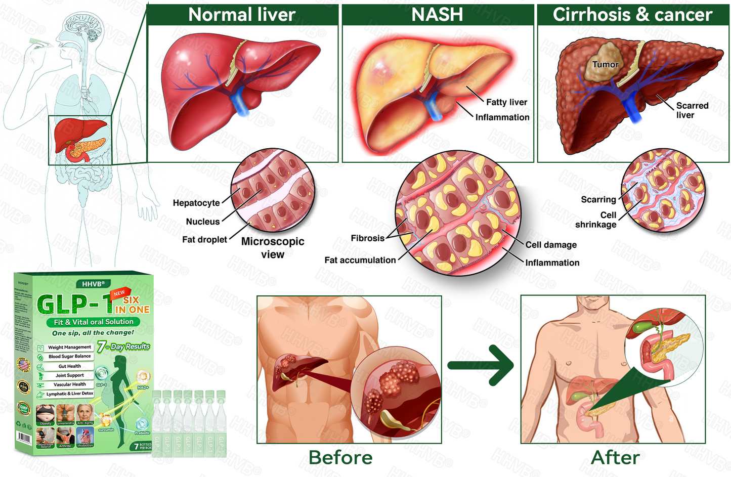 𝗛𝗛𝙑𝐵®💫3AP