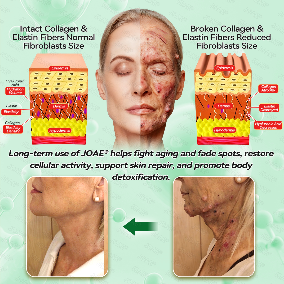 🇺🇸𝑂𝑓𝑓𝑖𝑐𝑖𝑎𝑙 𝑆𝑡𝑜𝑟𝑒 |🌿𝐉𝐎𝑨𝑬® 𝗖𝗼𝗹𝗹𝗮𝗴𝗲𝗻 𝗣𝗲𝗽𝘁𝗶𝗱𝗲𝘀 𝟲-𝗶𝗻-𝟭 𝗛𝗲𝗮𝗹𝘁𝗵 𝗦𝗼𝗹𝘂𝘁𝗶𝗼𝗻 𝗢𝗿𝗮𝗹 𝗟𝗶𝗾𝘂𝗶𝗱✅ 𝒔𝒖𝒑𝒑𝒐𝒓𝒕𝒔 𝒂𝒏𝒕𝒊-𝒂𝒈𝒊𝒏𝒈, 𝒘𝒓𝒊𝒏𝒌𝒍𝒆 𝒓𝒆𝒅𝒖𝒄𝒕𝒊𝒐𝒏, 𝒘𝒂𝒓𝒕 𝒂𝒏𝒅 𝒔𝒑𝒐𝒕 𝒓𝒆𝒎𝒐𝒗𝒂𝒍, 𝒄𝒂𝒓𝒅𝒊𝒐𝒗𝒂𝒔𝒄𝒖𝒍𝒂𝒓 𝒉𝒆𝒂𝒍𝒕𝒉, 𝒊𝒎𝒎𝒖𝒏𝒆 𝒃𝒐𝒐𝒔𝒕, 𝒈𝒖𝒕 𝒃𝒂𝒍𝒂𝒏𝒄𝒆, 𝒋𝒐𝒊𝒏𝒕 𝒄𝒂𝒓𝒆, 𝒂𝒏𝒅 𝒎𝒐𝒓𝒆.