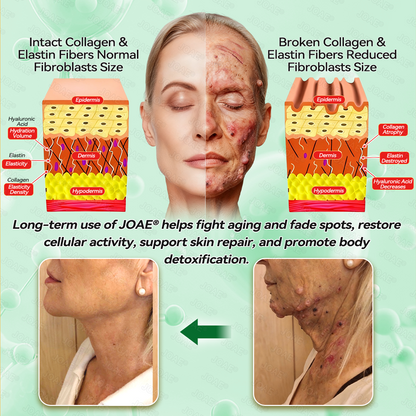 🇺🇸𝑂𝑓𝑓𝑖𝑐𝑖𝑎𝑙 𝑆𝑡𝑜𝑟𝑒 |🌿𝐉𝐎𝑨𝑬® 𝗖𝗼𝗹𝗹𝗮𝗴𝗲𝗻 𝗣𝗲𝗽𝘁𝗶𝗱𝗲𝘀 𝟲-𝗶𝗻-𝟭 𝗛𝗲𝗮𝗹𝘁𝗵 𝗦𝗼𝗹𝘂𝘁𝗶𝗼𝗻 𝗢𝗿𝗮𝗹 𝗟𝗶𝗾𝘂𝗶𝗱✅ 𝒔𝒖𝒑𝒑𝒐𝒓𝒕𝒔 𝒂𝒏𝒕𝒊-𝒂𝒈𝒊𝒏𝒈, 𝒘𝒓𝒊𝒏𝒌𝒍𝒆 𝒓𝒆𝒅𝒖𝒄𝒕𝒊𝒐𝒏, 𝒘𝒂𝒓𝒕 𝒂𝒏𝒅 𝒔𝒑𝒐𝒕 𝒓𝒆𝒎𝒐𝒗𝒂𝒍, 𝒄𝒂𝒓𝒅𝒊𝒐𝒗𝒂𝒔𝒄𝒖𝒍𝒂𝒓 𝒉𝒆𝒂𝒍𝒕𝒉, 𝒊𝒎𝒎𝒖𝒏𝒆 𝒃𝒐𝒐𝒔𝒕, 𝒈𝒖𝒕 𝒃𝒂𝒍𝒂𝒏𝒄𝒆, 𝒋𝒐𝒊𝒏𝒕 𝒄𝒂𝒓𝒆, 𝒂𝒏𝒅 𝒎𝒐𝒓𝒆.