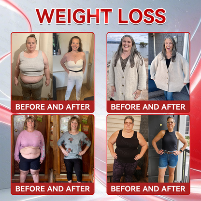 🇺🇸𝑶𝒇𝒇𝒊𝒄𝒊𝒂𝒍 𝑺𝒕𝒐𝒓𝒆𝑰𝐻𝐻𝑉𝐵®🌟𝑮𝑳𝑷-1+𝑪𝒐𝒍𝒍𝒂𝒈𝒆𝒏 𝑷𝒆𝒑𝒕𝒊𝒅𝒆𝒔 𝑾𝒆𝒊𝒈𝒉𝒕 𝑳𝒐𝒔𝒔&𝑭𝒊𝒓𝒎𝒊𝒏𝒈 𝑶𝒓𝒂𝒍 𝑺𝒐𝒍𝒖𝒕𝒊𝒐𝒏 𝒘𝒊𝒕𝒉 🔥𝑪𝒐𝒍𝒍𝒂𝒈𝒆𝒏 𝑷𝒆𝒑𝒕𝒊𝒅𝒆𝒔 & 𝑴𝒂𝒕𝒓𝒊𝒙𝒚𝒍 3000 𝒉𝒆𝒍𝒑𝒔 𝒕𝒂𝒓𝒈𝒆𝒕 ✅𝒐𝒃𝒆𝒔𝒊𝒕𝒚, 𝒇𝒊𝒓𝒎𝒔 𝒔𝒌𝒊𝒏,𝒄𝒂𝒓𝒅𝒊𝒐𝒗𝒂𝒔𝒄𝒖𝒍𝒂𝒓 𝒅𝒊𝒔𝒆𝒂𝒔𝒆, 𝒅𝒊𝒂𝒃𝒆𝒕𝒆𝒔, 𝒔𝒍𝒆𝒆𝒑 𝒂𝒑𝒏𝒆𝒂, 𝒋𝒐𝒊𝒏𝒕 𝒑𝒓𝒐𝒃𝒍𝒆𝒎𝒔, 𝒂𝒏𝒅 𝒎𝒐𝒓𝒆