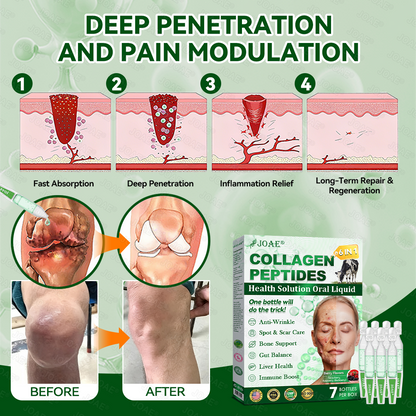 🇺🇸𝑂𝑓𝑓𝑖𝑐𝑖𝑎𝑙 𝑆𝑡𝑜𝑟𝑒 |🌿𝐉𝐎𝑨𝑬® 𝗖𝗼𝗹𝗹𝗮𝗴𝗲𝗻 𝗣𝗲𝗽𝘁𝗶𝗱𝗲𝘀 𝟲-𝗶𝗻-𝟭 𝗛𝗲𝗮𝗹𝘁𝗵 𝗦𝗼𝗹𝘂𝘁𝗶𝗼𝗻 𝗢𝗿𝗮𝗹 𝗟𝗶𝗾𝘂𝗶𝗱✅ 𝒔𝒖𝒑𝒑𝒐𝒓𝒕𝒔 𝒂𝒏𝒕𝒊-𝒂𝒈𝒊𝒏𝒈, 𝒘𝒓𝒊𝒏𝒌𝒍𝒆 𝒓𝒆𝒅𝒖𝒄𝒕𝒊𝒐𝒏, 𝒘𝒂𝒓𝒕 𝒂𝒏𝒅 𝒔𝒑𝒐𝒕 𝒓𝒆𝒎𝒐𝒗𝒂𝒍, 𝒄𝒂𝒓𝒅𝒊𝒐𝒗𝒂𝒔𝒄𝒖𝒍𝒂𝒓 𝒉𝒆𝒂𝒍𝒕𝒉, 𝒊𝒎𝒎𝒖𝒏𝒆 𝒃𝒐𝒐𝒔𝒕, 𝒈𝒖𝒕 𝒃𝒂𝒍𝒂𝒏𝒄𝒆, 𝒋𝒐𝒊𝒏𝒕 𝒄𝒂𝒓𝒆, 𝒂𝒏𝒅 𝒎𝒐𝒓𝒆.