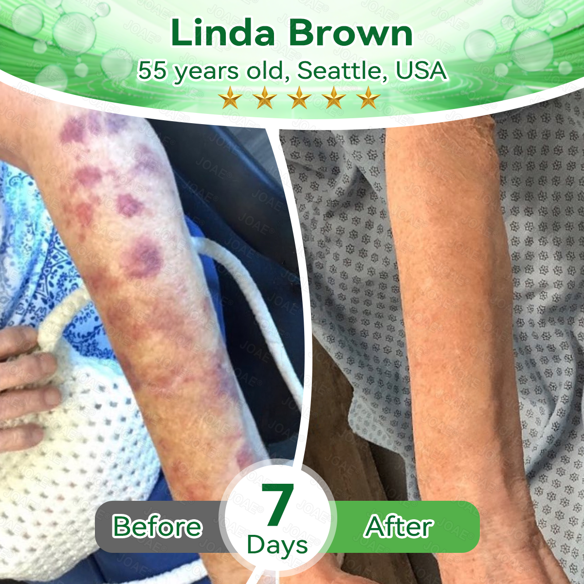 🇺🇸𝑂𝑓𝑓𝑖𝑐𝑖𝑎𝑙 𝑆𝑡𝑜𝑟𝑒 |🌿𝐉𝐎𝑨𝑬® 𝗖𝗼𝗹𝗹𝗮𝗴𝗲𝗻 𝗣𝗲𝗽𝘁𝗶𝗱𝗲𝘀 𝟲-𝗶𝗻-𝟭 𝗛𝗲𝗮𝗹𝘁𝗵 𝗦𝗼𝗹𝘂𝘁𝗶𝗼𝗻 𝗢𝗿𝗮𝗹 𝗟𝗶𝗾𝘂𝗶𝗱✅ 𝒔𝒖𝒑𝒑𝒐𝒓𝒕𝒔 𝒂𝒏𝒕𝒊-𝒂𝒈𝒊𝒏𝒈, 𝒘𝒓𝒊𝒏𝒌𝒍𝒆 𝒓𝒆𝒅𝒖𝒄𝒕𝒊𝒐𝒏, 𝒘𝒂𝒓𝒕 𝒂𝒏𝒅 𝒔𝒑𝒐𝒕 𝒓𝒆𝒎𝒐𝒗𝒂𝒍, 𝒄𝒂𝒓𝒅𝒊𝒐𝒗𝒂𝒔𝒄𝒖𝒍𝒂𝒓 𝒉𝒆𝒂𝒍𝒕𝒉, 𝒊𝒎𝒎𝒖𝒏𝒆 𝒃𝒐𝒐𝒔𝒕, 𝒈𝒖𝒕 𝒃𝒂𝒍𝒂𝒏𝒄𝒆, 𝒋𝒐𝒊𝒏𝒕 𝒄𝒂𝒓𝒆, 𝒂𝒏𝒅 𝒎𝒐𝒓𝒆.