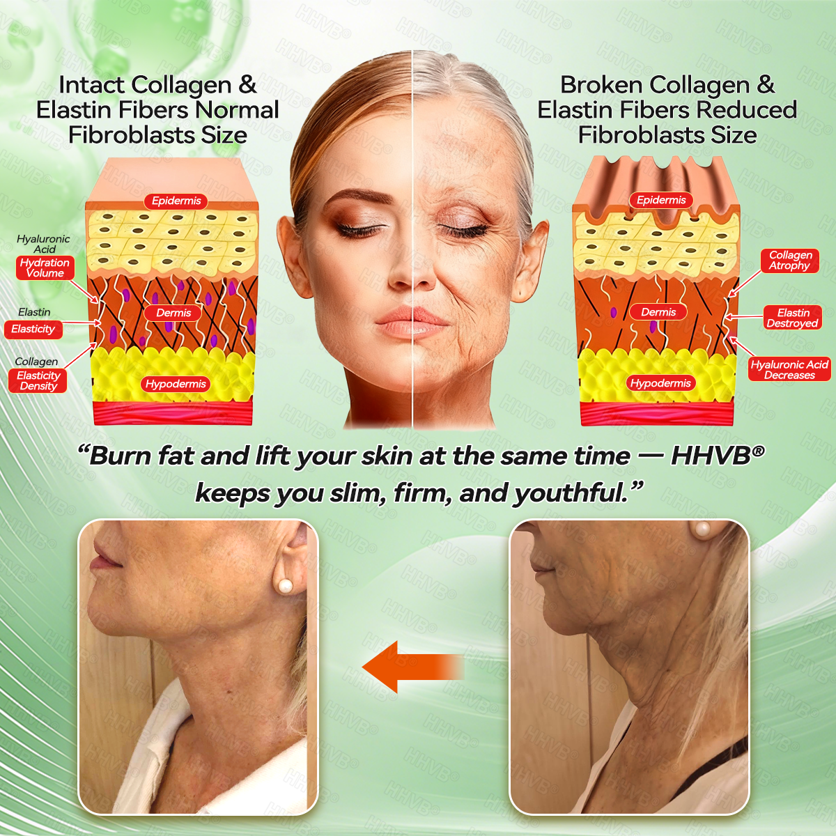 𝗛𝗛𝙑𝐵®💫3AP