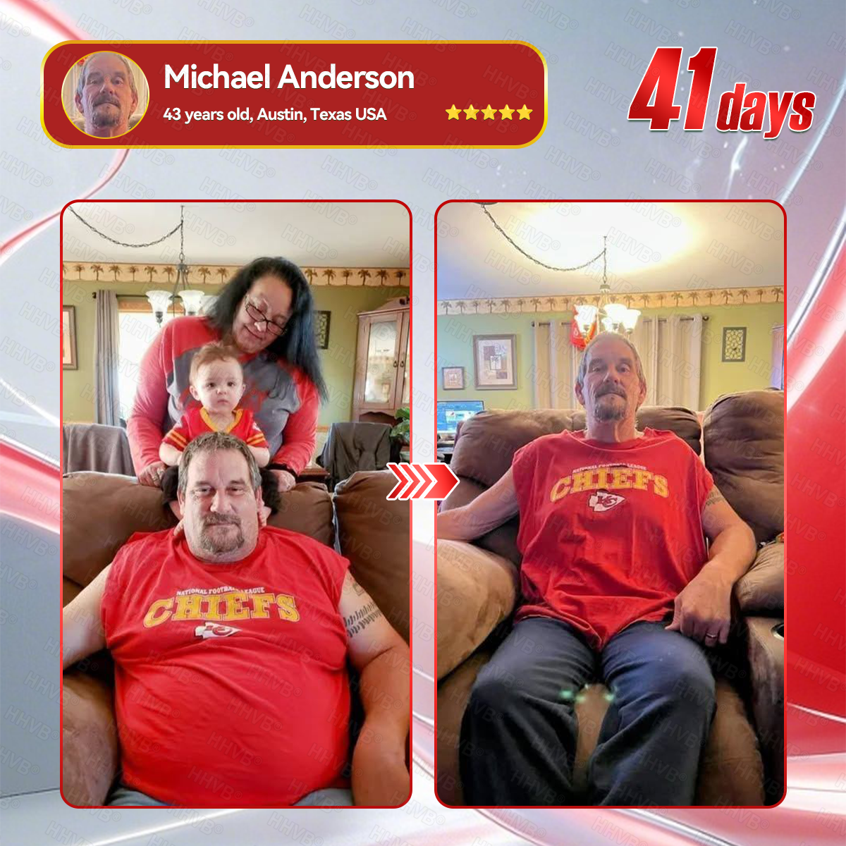 🇺🇸𝑶𝒇𝒇𝒊𝒄𝒊𝒂𝒍 𝑺𝒕𝒐𝒓𝒆𝑰𝐻𝐻𝑉𝐵®🌟𝑮𝑳𝑷-1+𝑪𝒐𝒍𝒍𝒂𝒈𝒆𝒏 𝑷𝒆𝒑𝒕𝒊𝒅𝒆𝒔 𝑾𝒆𝒊𝒈𝒉𝒕 𝑳𝒐𝒔𝒔&𝑭𝒊𝒓𝒎𝒊𝒏𝒈 𝑶𝒓𝒂𝒍 𝑺𝒐𝒍𝒖𝒕𝒊𝒐𝒏 𝒘𝒊𝒕𝒉 🔥𝑪𝒐𝒍𝒍𝒂𝒈𝒆𝒏 𝑷𝒆𝒑𝒕𝒊𝒅𝒆𝒔 & 𝑴𝒂𝒕𝒓𝒊𝒙𝒚𝒍 3000 𝒉𝒆𝒍𝒑𝒔 𝒕𝒂𝒓𝒈𝒆𝒕 ✅𝒐𝒃𝒆𝒔𝒊𝒕𝒚, 𝒇𝒊𝒓𝒎𝒔 𝒔𝒌𝒊𝒏,𝒄𝒂𝒓𝒅𝒊𝒐𝒗𝒂𝒔𝒄𝒖𝒍𝒂𝒓 𝒅𝒊𝒔𝒆𝒂𝒔𝒆, 𝒅𝒊𝒂𝒃𝒆𝒕𝒆𝒔, 𝒔𝒍𝒆𝒆𝒑 𝒂𝒑𝒏𝒆𝒂, 𝒋𝒐𝒊𝒏𝒕 𝒑𝒓𝒐𝒃𝒍𝒆𝒎𝒔, 𝒂𝒏𝒅 𝒎𝒐𝒓𝒆