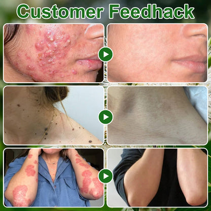 🇺🇸𝑂𝑓𝑓𝑖𝑐𝑖𝑎𝑙 𝑆𝑡𝑜𝑟𝑒 |🌿𝐉𝐎𝑨𝑬® 𝗖𝗼𝗹𝗹𝗮𝗴𝗲𝗻 𝗣𝗲𝗽𝘁𝗶𝗱𝗲𝘀 𝟲-𝗶𝗻-𝟭 𝗛𝗲𝗮𝗹𝘁𝗵 𝗦𝗼𝗹𝘂𝘁𝗶𝗼𝗻 𝗢𝗿𝗮𝗹 𝗟𝗶𝗾𝘂𝗶𝗱✅ 𝒔𝒖𝒑𝒑𝒐𝒓𝒕𝒔 𝒂𝒏𝒕𝒊-𝒂𝒈𝒊𝒏𝒈, 𝒘𝒓𝒊𝒏𝒌𝒍𝒆 𝒓𝒆𝒅𝒖𝒄𝒕𝒊𝒐𝒏, 𝒘𝒂𝒓𝒕 𝒂𝒏𝒅 𝒔𝒑𝒐𝒕 𝒓𝒆𝒎𝒐𝒗𝒂𝒍, 𝒄𝒂𝒓𝒅𝒊𝒐𝒗𝒂𝒔𝒄𝒖𝒍𝒂𝒓 𝒉𝒆𝒂𝒍𝒕𝒉, 𝒊𝒎𝒎𝒖𝒏𝒆 𝒃𝒐𝒐𝒔𝒕, 𝒈𝒖𝒕 𝒃𝒂𝒍𝒂𝒏𝒄𝒆, 𝒋𝒐𝒊𝒏𝒕 𝒄𝒂𝒓𝒆, 𝒂𝒏𝒅 𝒎𝒐𝒓𝒆.