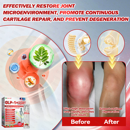 🇺🇸𝑶𝒇𝒇𝒊𝒄𝒊𝒂𝒍 𝑺𝒕𝒐𝒓𝒆𝑰𝐻𝐻𝑉𝐵®🌟𝑮𝑳𝑷-1+𝑪𝒐𝒍𝒍𝒂𝒈𝒆𝒏 𝑷𝒆𝒑𝒕𝒊𝒅𝒆𝒔 𝑾𝒆𝒊𝒈𝒉𝒕 𝑳𝒐𝒔𝒔&𝑭𝒊𝒓𝒎𝒊𝒏𝒈 𝑶𝒓𝒂𝒍 𝑺𝒐𝒍𝒖𝒕𝒊𝒐𝒏 𝒘𝒊𝒕𝒉 🔥𝑪𝒐𝒍𝒍𝒂𝒈𝒆𝒏 𝑷𝒆𝒑𝒕𝒊𝒅𝒆𝒔 & 𝑴𝒂𝒕𝒓𝒊𝒙𝒚𝒍 3000 𝒉𝒆𝒍𝒑𝒔 𝒕𝒂𝒓𝒈𝒆𝒕 ✅𝒐𝒃𝒆𝒔𝒊𝒕𝒚, 𝒇𝒊𝒓𝒎𝒔 𝒔𝒌𝒊𝒏,𝒄𝒂𝒓𝒅𝒊𝒐𝒗𝒂𝒔𝒄𝒖𝒍𝒂𝒓 𝒅𝒊𝒔𝒆𝒂𝒔𝒆, 𝒅𝒊𝒂𝒃𝒆𝒕𝒆𝒔, 𝒔𝒍𝒆𝒆𝒑 𝒂𝒑𝒏𝒆𝒂, 𝒋𝒐𝒊𝒏𝒕 𝒑𝒓𝒐𝒃𝒍𝒆𝒎𝒔, 𝒂𝒏𝒅 𝒎𝒐𝒓𝒆