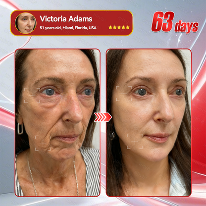 🇺🇸𝑶𝒇𝒇𝒊𝒄𝒊𝒂𝒍 𝑺𝒕𝒐𝒓𝒆𝑰𝐻𝐻𝑉𝐵®🌟𝑮𝑳𝑷-1+𝑪𝒐𝒍𝒍𝒂𝒈𝒆𝒏 𝑷𝒆𝒑𝒕𝒊𝒅𝒆𝒔 𝑾𝒆𝒊𝒈𝒉𝒕 𝑳𝒐𝒔𝒔&𝑭𝒊𝒓𝒎𝒊𝒏𝒈 𝑶𝒓𝒂𝒍 𝑺𝒐𝒍𝒖𝒕𝒊𝒐𝒏 𝒘𝒊𝒕𝒉 🔥𝑪𝒐𝒍𝒍𝒂𝒈𝒆𝒏 𝑷𝒆𝒑𝒕𝒊𝒅𝒆𝒔 & 𝑴𝒂𝒕𝒓𝒊𝒙𝒚𝒍 3000 𝒉𝒆𝒍𝒑𝒔 𝒕𝒂𝒓𝒈𝒆𝒕 ✅𝒐𝒃𝒆𝒔𝒊𝒕𝒚, 𝒇𝒊𝒓𝒎𝒔 𝒔𝒌𝒊𝒏,𝒄𝒂𝒓𝒅𝒊𝒐𝒗𝒂𝒔𝒄𝒖𝒍𝒂𝒓 𝒅𝒊𝒔𝒆𝒂𝒔𝒆, 𝒅𝒊𝒂𝒃𝒆𝒕𝒆𝒔, 𝒔𝒍𝒆𝒆𝒑 𝒂𝒑𝒏𝒆𝒂, 𝒋𝒐𝒊𝒏𝒕 𝒑𝒓𝒐𝒃𝒍𝒆𝒎𝒔, 𝒂𝒏𝒅 𝒎𝒐𝒓𝒆