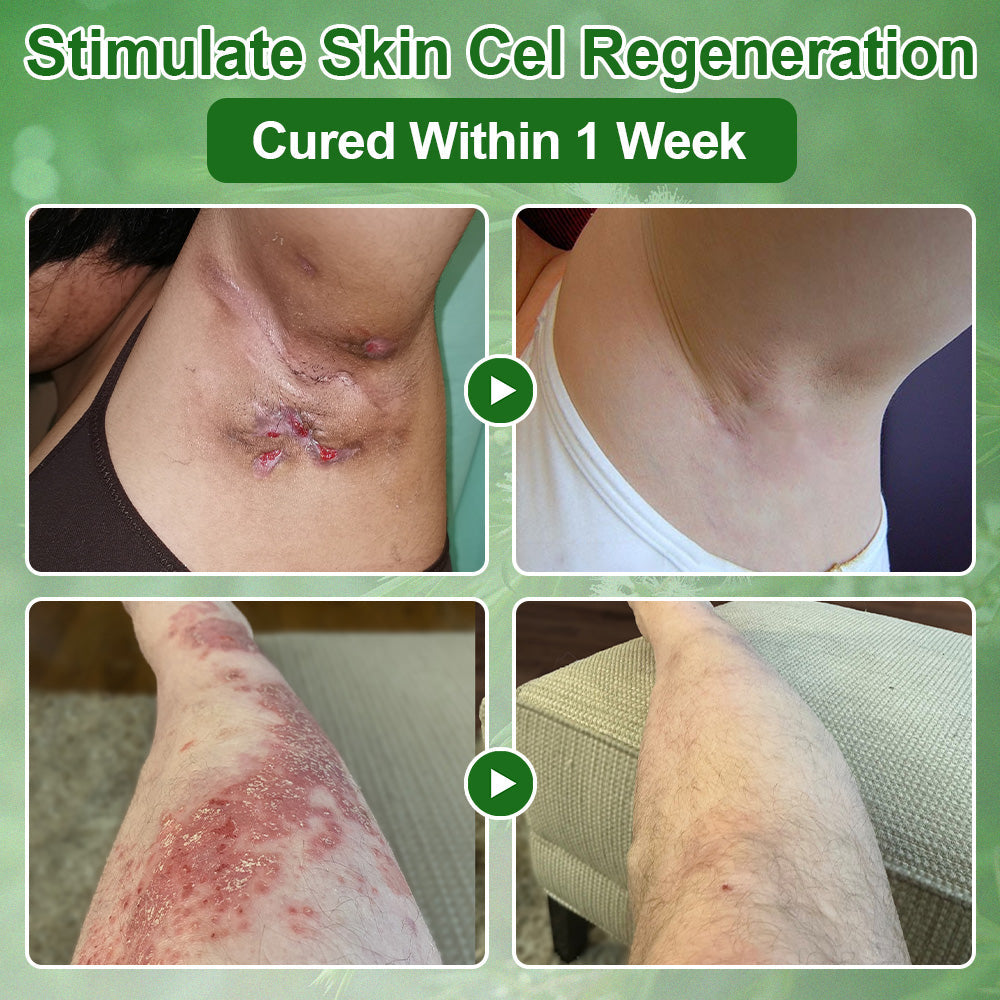 🇺🇸𝑂𝑓𝑓𝑖𝑐𝑖𝑎𝑙 𝑆𝑡𝑜𝑟𝑒 |🌿𝐉𝐎𝑨𝑬® 𝗖𝗼𝗹𝗹𝗮𝗴𝗲𝗻 𝗣𝗲𝗽𝘁𝗶𝗱𝗲𝘀 𝟲-𝗶𝗻-𝟭 𝗛𝗲𝗮𝗹𝘁𝗵 𝗦𝗼𝗹𝘂𝘁𝗶𝗼𝗻 𝗢𝗿𝗮𝗹 𝗟𝗶𝗾𝘂𝗶𝗱✅ 𝒔𝒖𝒑𝒑𝒐𝒓𝒕𝒔 𝒂𝒏𝒕𝒊-𝒂𝒈𝒊𝒏𝒈, 𝒘𝒓𝒊𝒏𝒌𝒍𝒆 𝒓𝒆𝒅𝒖𝒄𝒕𝒊𝒐𝒏, 𝒘𝒂𝒓𝒕 𝒂𝒏𝒅 𝒔𝒑𝒐𝒕 𝒓𝒆𝒎𝒐𝒗𝒂𝒍, 𝒄𝒂𝒓𝒅𝒊𝒐𝒗𝒂𝒔𝒄𝒖𝒍𝒂𝒓 𝒉𝒆𝒂𝒍𝒕𝒉, 𝒊𝒎𝒎𝒖𝒏𝒆 𝒃𝒐𝒐𝒔𝒕, 𝒈𝒖𝒕 𝒃𝒂𝒍𝒂𝒏𝒄𝒆, 𝒋𝒐𝒊𝒏𝒕 𝒄𝒂𝒓𝒆, 𝒂𝒏𝒅 𝒎𝒐𝒓𝒆.