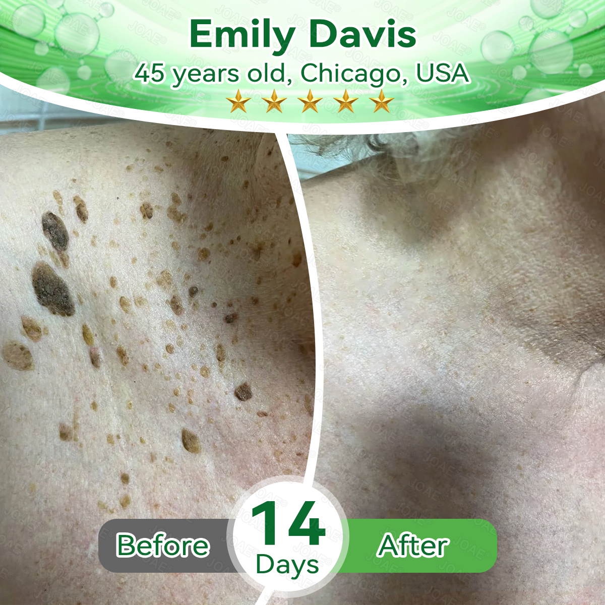 🇺🇸𝑂𝑓𝑓𝑖𝑐𝑖𝑎𝑙 𝑆𝑡𝑜𝑟𝑒 |🌿𝐉𝐎𝑨𝑬® 𝗖𝗼𝗹𝗹𝗮𝗴𝗲𝗻 𝗣𝗲𝗽𝘁𝗶𝗱𝗲𝘀 𝟲-𝗶𝗻-𝟭 𝗛𝗲𝗮𝗹𝘁𝗵 𝗦𝗼𝗹𝘂𝘁𝗶𝗼𝗻 𝗢𝗿𝗮𝗹 𝗟𝗶𝗾𝘂𝗶𝗱✅ 𝒔𝒖𝒑𝒑𝒐𝒓𝒕𝒔 𝒂𝒏𝒕𝒊-𝒂𝒈𝒊𝒏𝒈, 𝒘𝒓𝒊𝒏𝒌𝒍𝒆 𝒓𝒆𝒅𝒖𝒄𝒕𝒊𝒐𝒏, 𝒘𝒂𝒓𝒕 𝒂𝒏𝒅 𝒔𝒑𝒐𝒕 𝒓𝒆𝒎𝒐𝒗𝒂𝒍, 𝒄𝒂𝒓𝒅𝒊𝒐𝒗𝒂𝒔𝒄𝒖𝒍𝒂𝒓 𝒉𝒆𝒂𝒍𝒕𝒉, 𝒊𝒎𝒎𝒖𝒏𝒆 𝒃𝒐𝒐𝒔𝒕, 𝒈𝒖𝒕 𝒃𝒂𝒍𝒂𝒏𝒄𝒆, 𝒋𝒐𝒊𝒏𝒕 𝒄𝒂𝒓𝒆, 𝒂𝒏𝒅 𝒎𝒐𝒓𝒆.