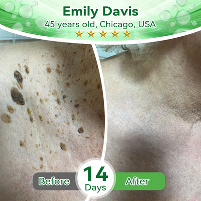 🇺🇸𝑂𝑓𝑓𝑖𝑐𝑖𝑎𝑙 𝑆𝑡𝑜𝑟𝑒 |🌿𝐉𝐎𝑨𝑬® 𝗖𝗼𝗹𝗹𝗮𝗴𝗲𝗻 𝗣𝗲𝗽𝘁𝗶𝗱𝗲𝘀 𝟲-𝗶𝗻-𝟭 𝗛𝗲𝗮𝗹𝘁𝗵 𝗦𝗼𝗹𝘂𝘁𝗶𝗼𝗻 𝗢𝗿𝗮𝗹 𝗟𝗶𝗾𝘂𝗶𝗱✅ 𝒔𝒖𝒑𝒑𝒐𝒓𝒕𝒔 𝒂𝒏𝒕𝒊-𝒂𝒈𝒊𝒏𝒈, 𝒘𝒓𝒊𝒏𝒌𝒍𝒆 𝒓𝒆𝒅𝒖𝒄𝒕𝒊𝒐𝒏, 𝒘𝒂𝒓𝒕 𝒂𝒏𝒅 𝒔𝒑𝒐𝒕 𝒓𝒆𝒎𝒐𝒗𝒂𝒍, 𝒄𝒂𝒓𝒅𝒊𝒐𝒗𝒂𝒔𝒄𝒖𝒍𝒂𝒓 𝒉𝒆𝒂𝒍𝒕𝒉, 𝒊𝒎𝒎𝒖𝒏𝒆 𝒃𝒐𝒐𝒔𝒕, 𝒈𝒖𝒕 𝒃𝒂𝒍𝒂𝒏𝒄𝒆, 𝒋𝒐𝒊𝒏𝒕 𝒄𝒂𝒓𝒆, 𝒂𝒏𝒅 𝒎𝒐𝒓𝒆.